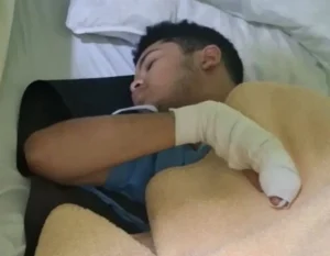تحرشوا بأخته وضربوه .. سيدة تروي تفاصيل قطع أصابع نجلها على يد مجموعة شباب بكمبوند دريم